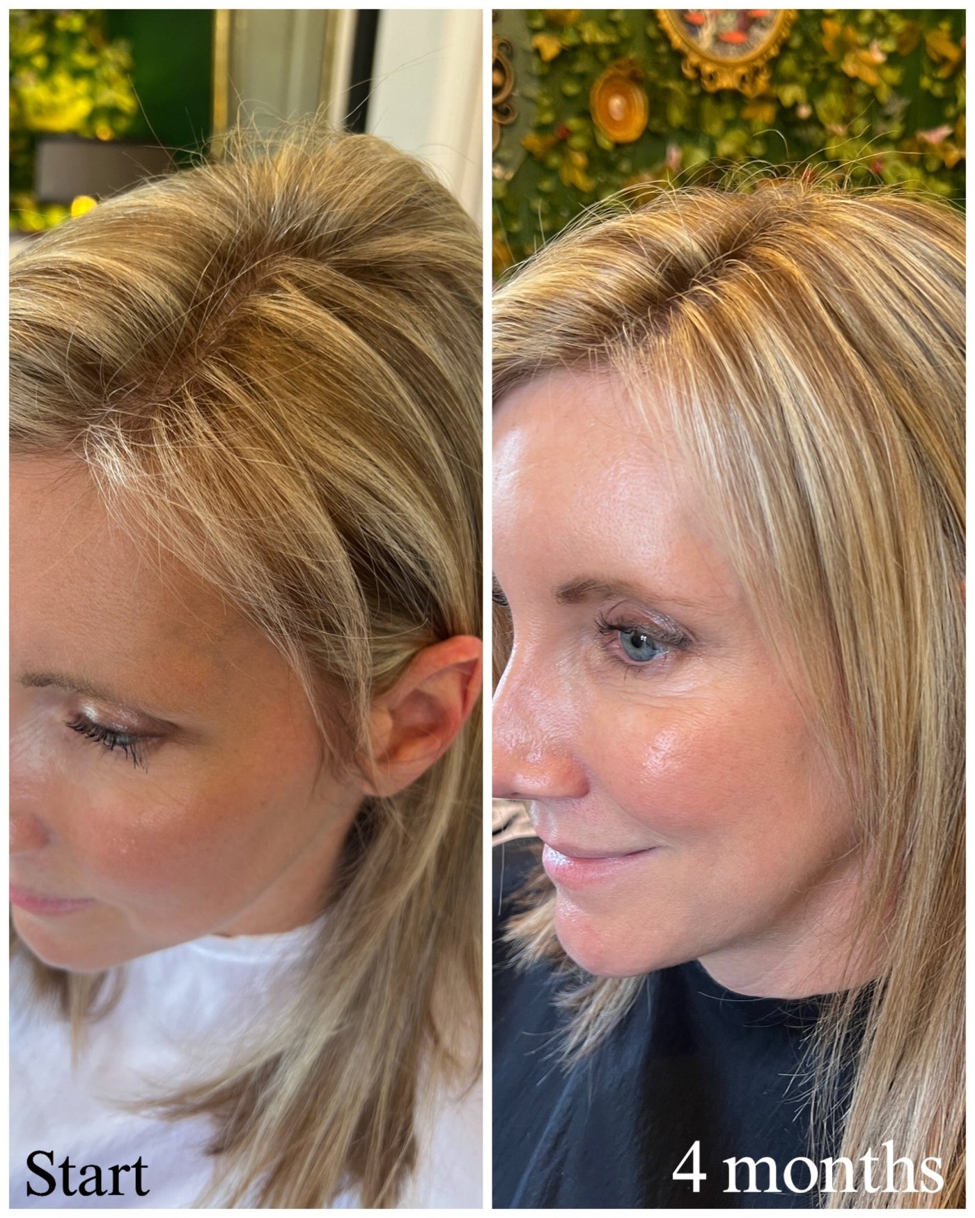 before and after using growth root spray