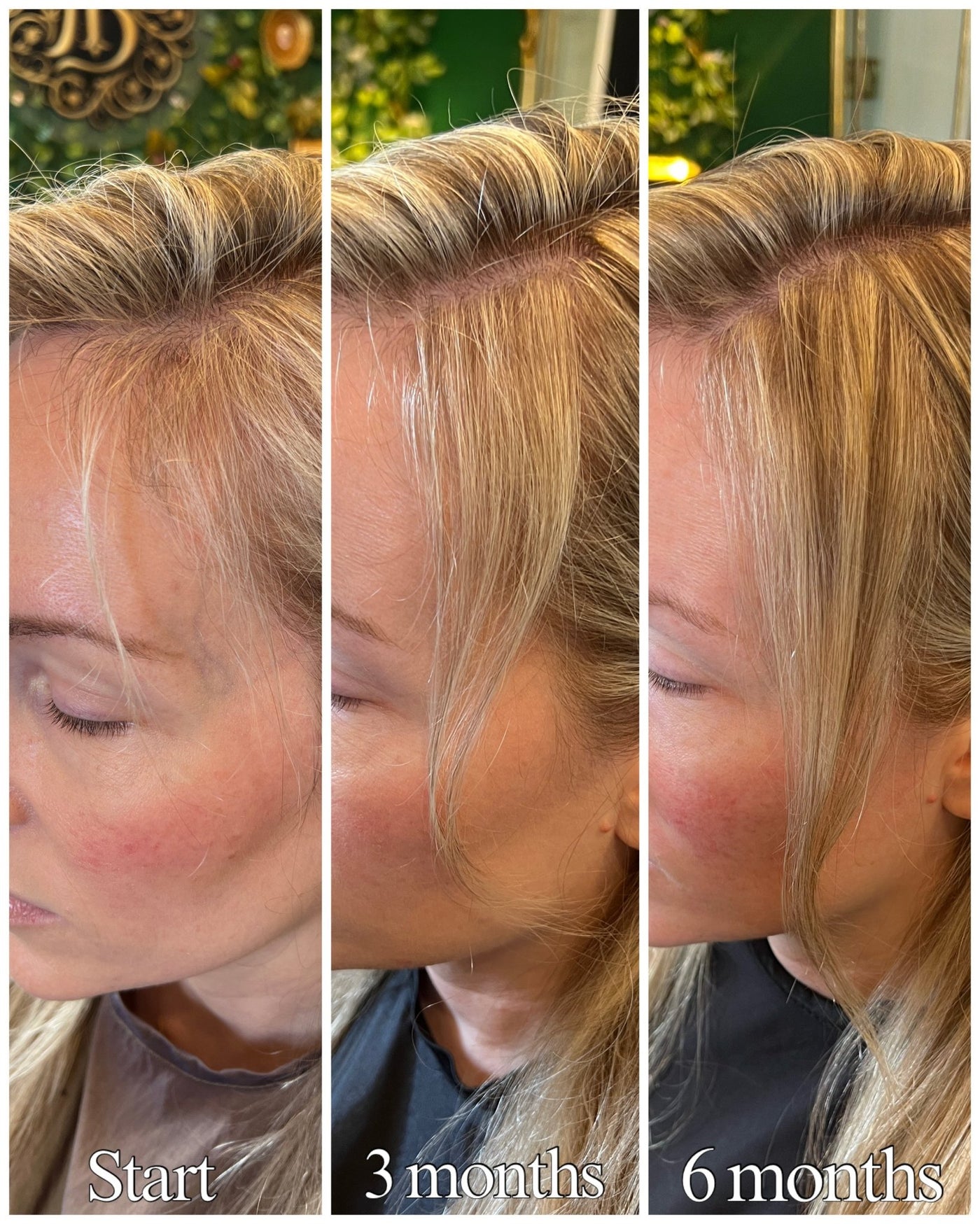 before and after using growth root spray