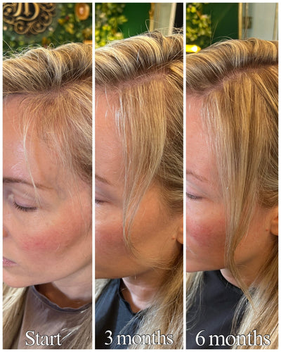 before and after using growth root spray