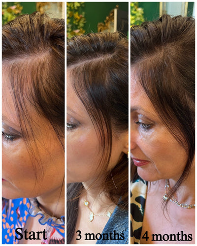 before and after using growth root spray