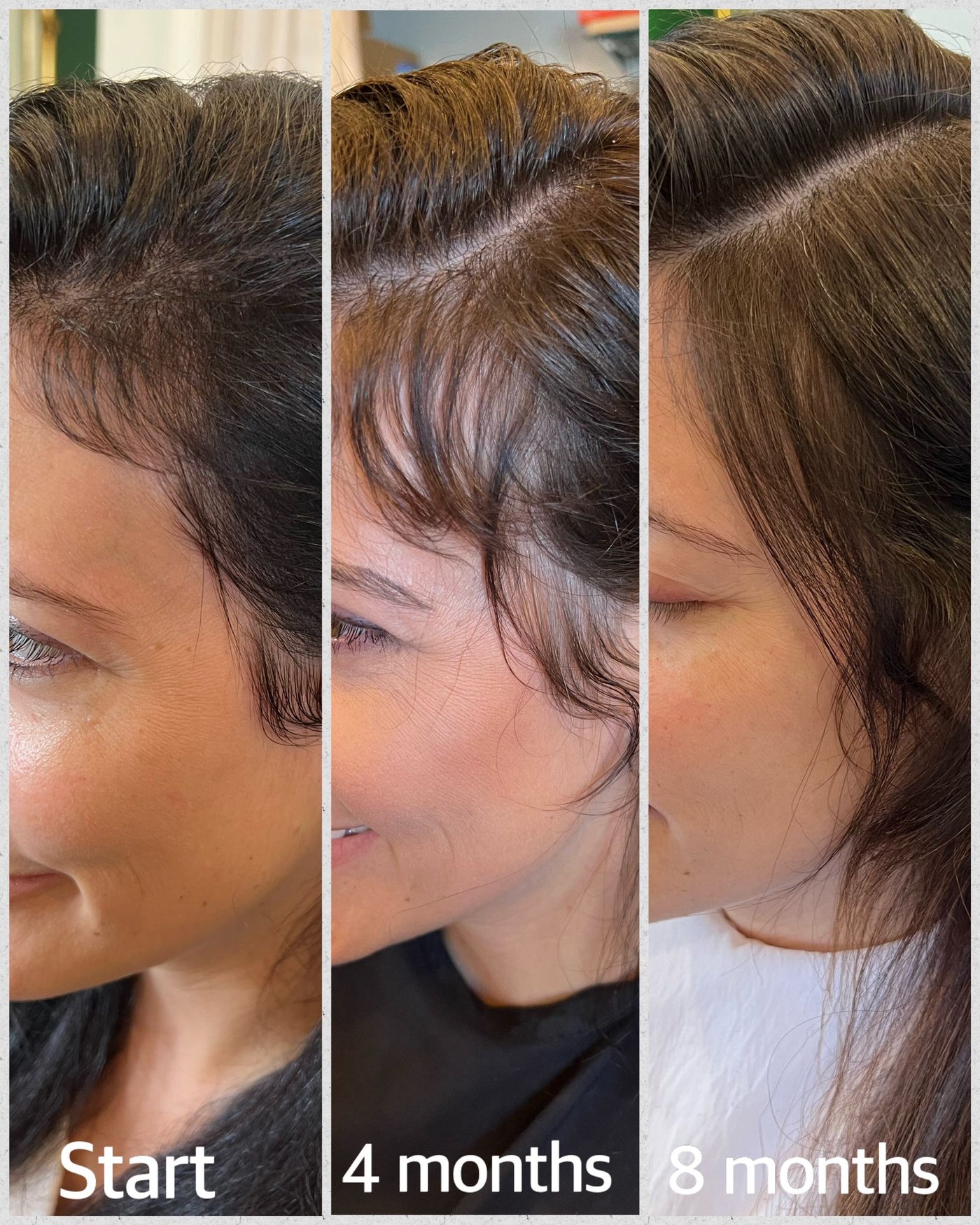 before and after using growth root spray