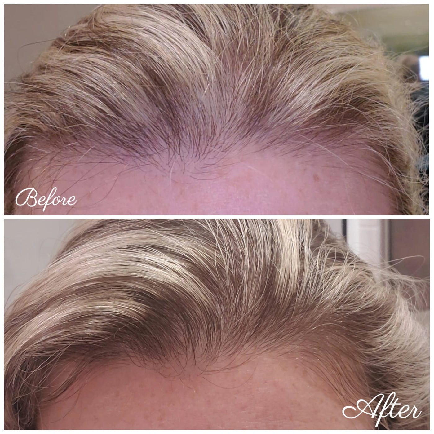 Ultimate Hair Growth Set